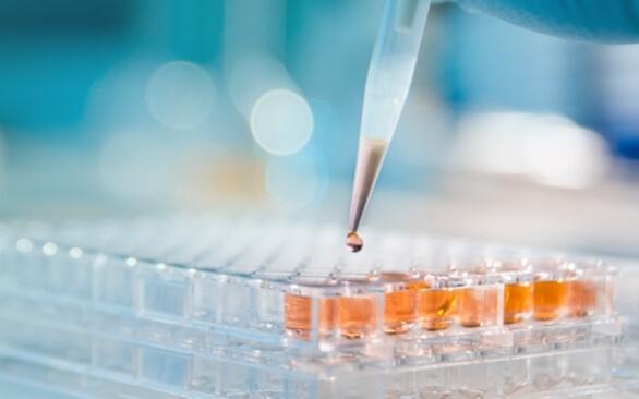 A importância da química analítica e da cromatografia para a qualidade da análise das amostras na indústria química